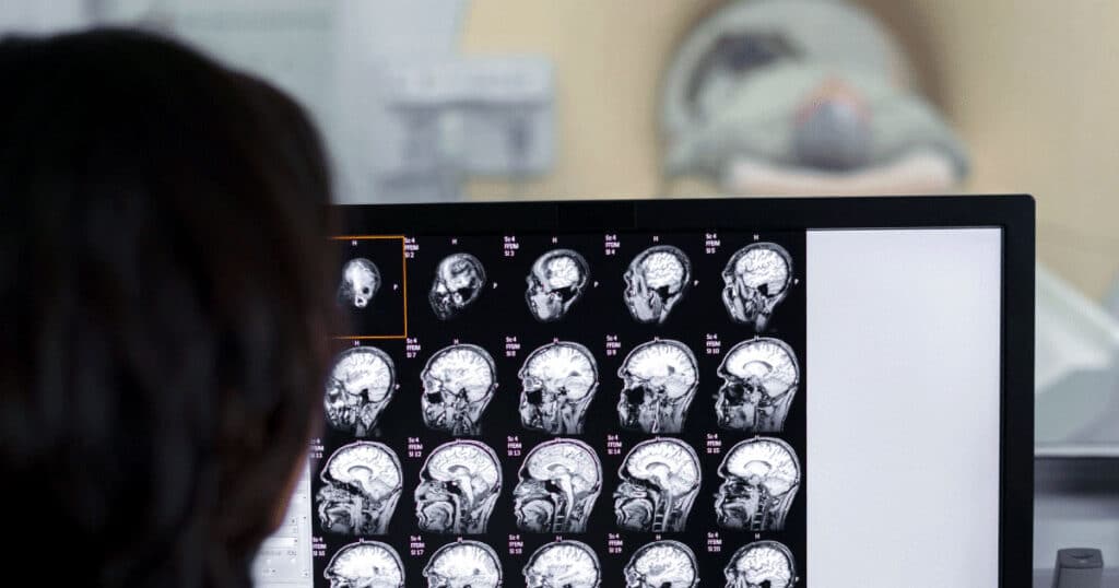 Medical professional viewing a computer monitor displaying multiple brain MRI scans in a clinic setting.